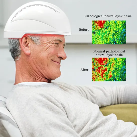 Macchina per terapia della luce a infrarossi con casco per stimolazione neuro Suyzeko per terapia di fotobiomodulazione